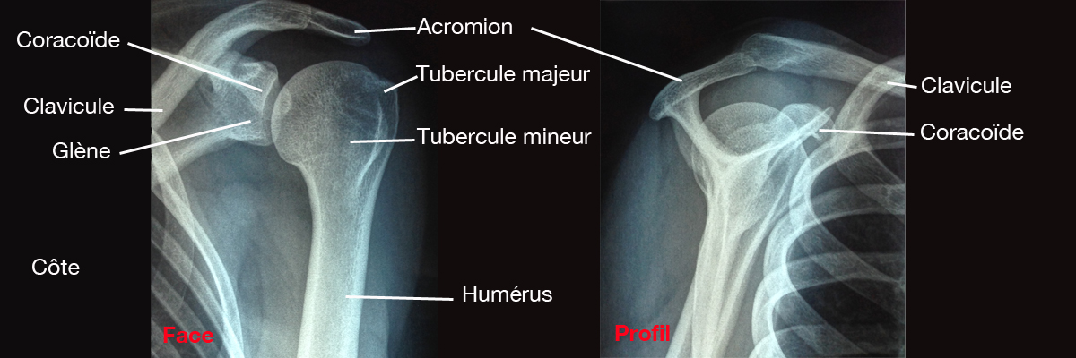 8-Radiographies de lindex et du majeur dune main droite
